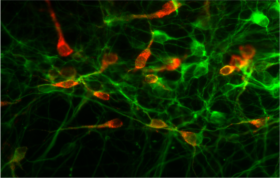 Auf Serotonin reagierende Neuronen (rot) im Gehirn der Maus. Bild: Natalia Alenina, MDC