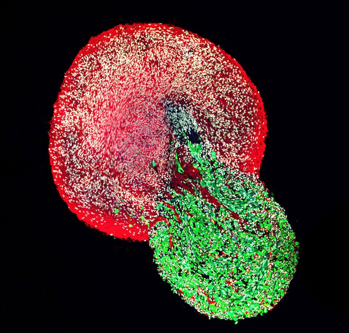 A section through a whole human neuromuscular organoid where spinal cord neurons (red) innervate the skeletal muscle cells (green). All cell nuclei are stained in white colour. © Jorge Miguel Faustino Martins, Gouti Lab, MDC