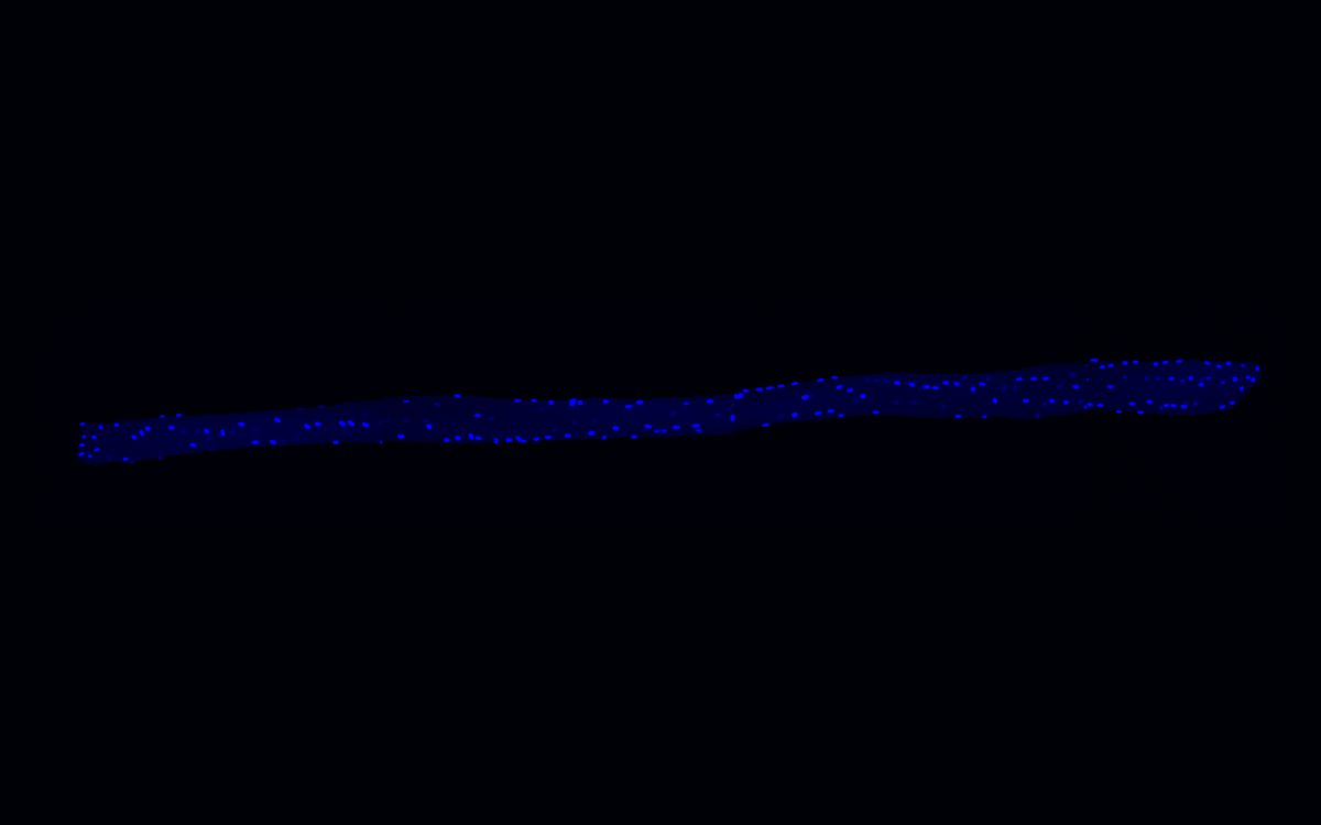 In this single muscle fiber, a multitude of nuclei can be clearly seen. The researchers used DAPI for staining, it stains the DNA in the nuclei blue. © C. Birchmeier Lab, MDC