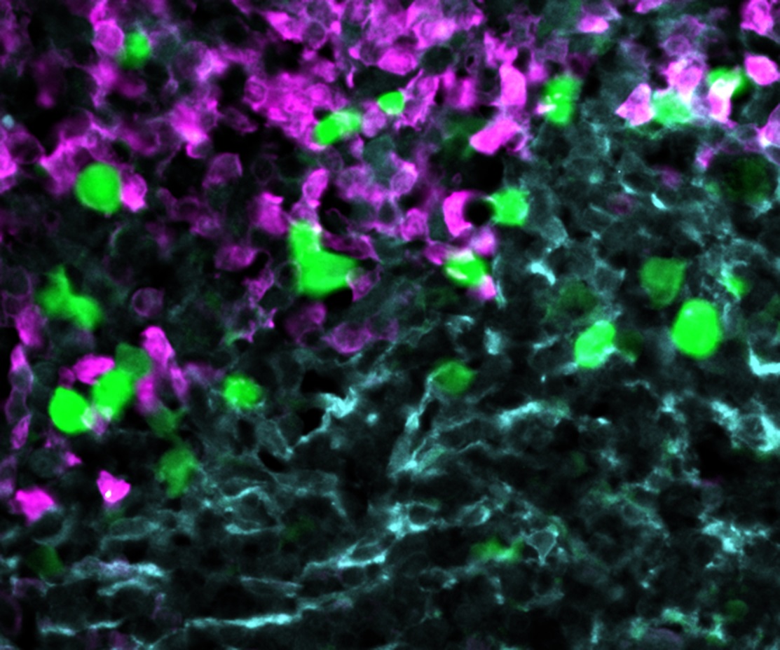 Die gegen CXCR5 gerichteten CAR-T-Zellen (grün) greifen Lymphom-Zellen (rot) innerhalb des Stroma-Zellnetzwerks im B-Zell-Follikel an (hellblau). Foto: AG Höpken
