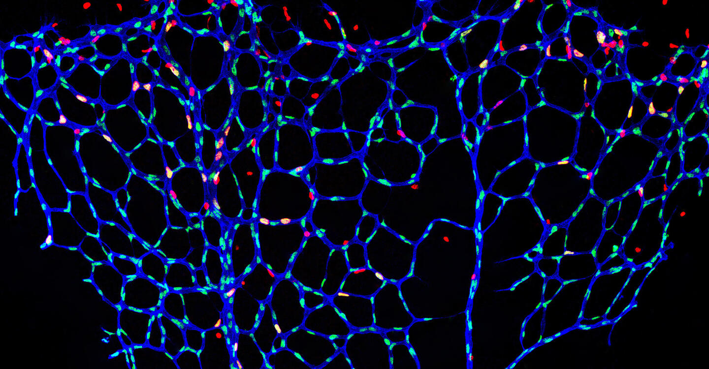 Gebremstes Blutgefäßwachstum: die mikroskopische Aufnahme zeigt die Netzhautgefäße einer Maus, bei der die S-2-Hydroxyglutarat-Spiegel im Endothel selektiv erhöht sind.