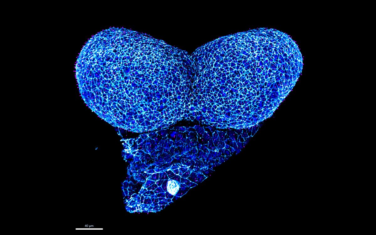 Vordere Neuralfalten in einem Mausembryo. Foto: AG Hammes, MDC