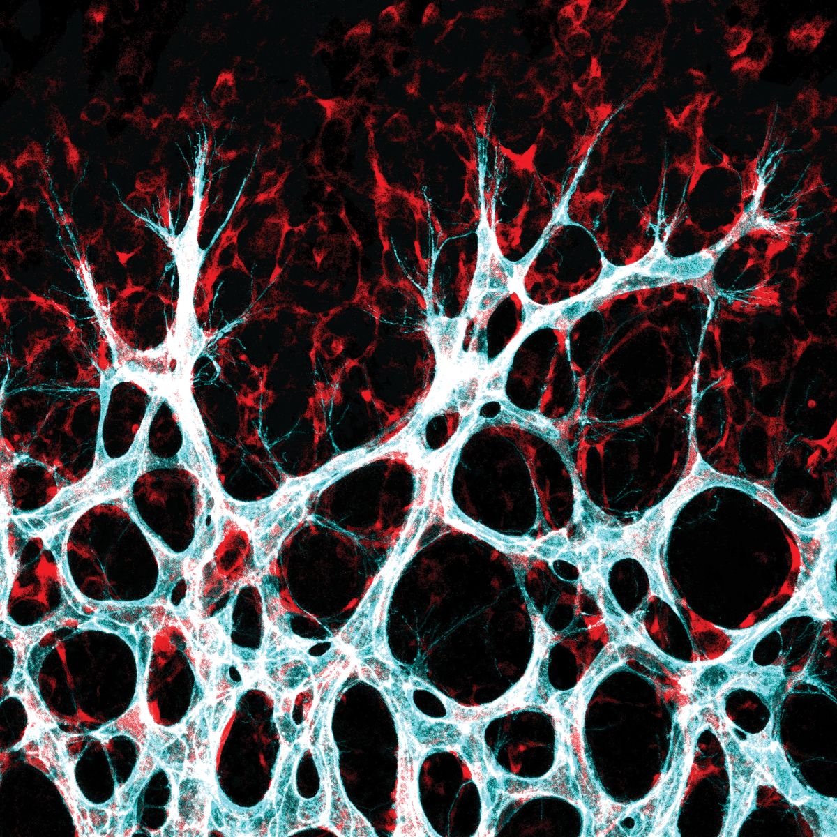 Wachsendes Blutgefäßnetzwerk in der Netzhaut der Maus: Zellen der Gefäßinnenwand – die Endothelzellen (türkis/weiß) – wandern in das umgebende Gewebe ein, um dort neue Verbindungen zu bilden. Foto: Michael Potente, MDC