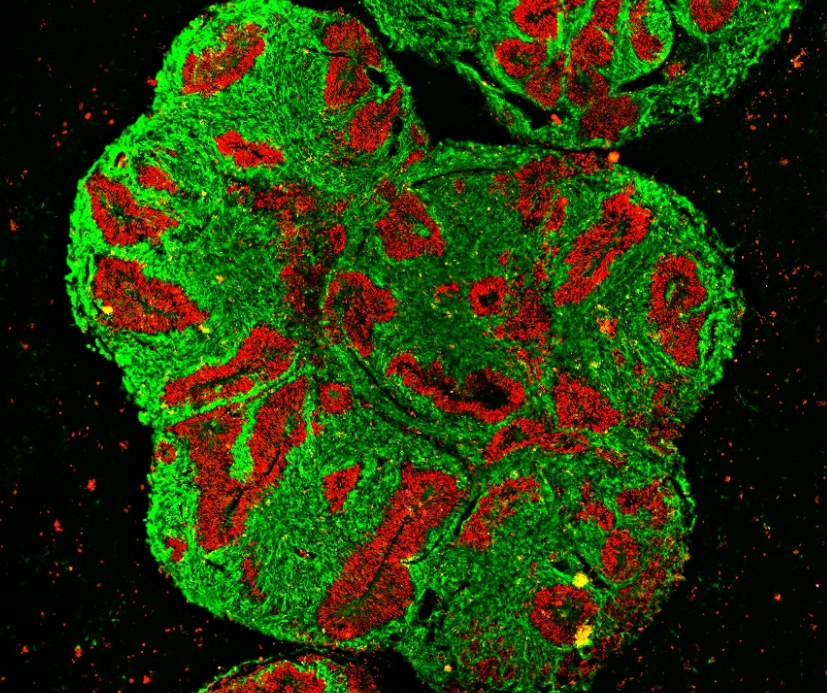 Das Hirn-Organoid eines Nashorns ist einen Monat alt. In der mikroskopischen Querschnitt-Aufnahme sind Vorläuferzellen von Nervenzellen in Rot zu sehen. Fertige Nervenzellen sind grün gefärbt. Foto: Silke Frahm-Barske, Max Delbrück Center