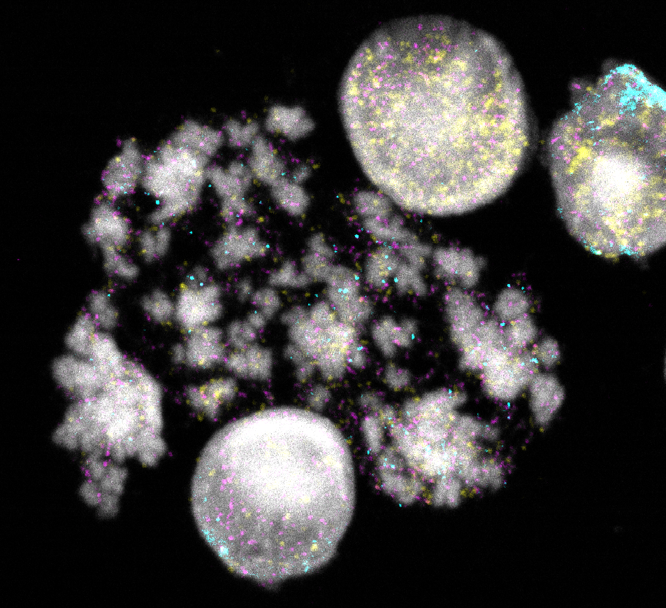 Nuclei and chromosomes of neuroblastoma cells. DNA rings are colored yellow, turquoise, or magenta. Each color is associated with different cancer genes. © Rocío Chamorro González, Charité