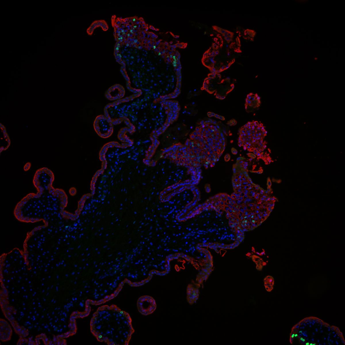 Die gefärbten Zellen sind Trophoblasten des Plazentagewebes. Foto: Rabia Anwar