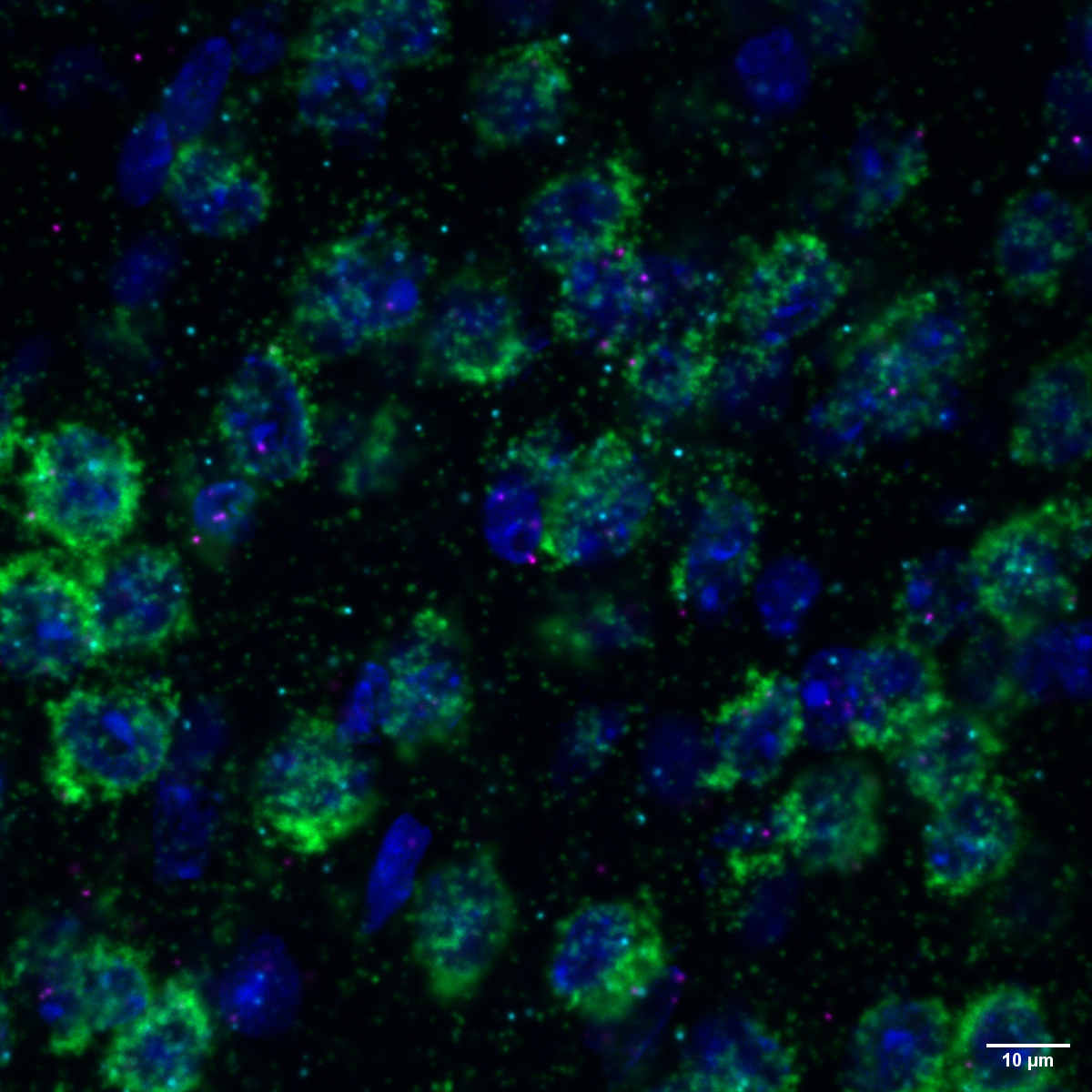 © Erika Uddström, Hörnberg Lab, Max Delbrück Center