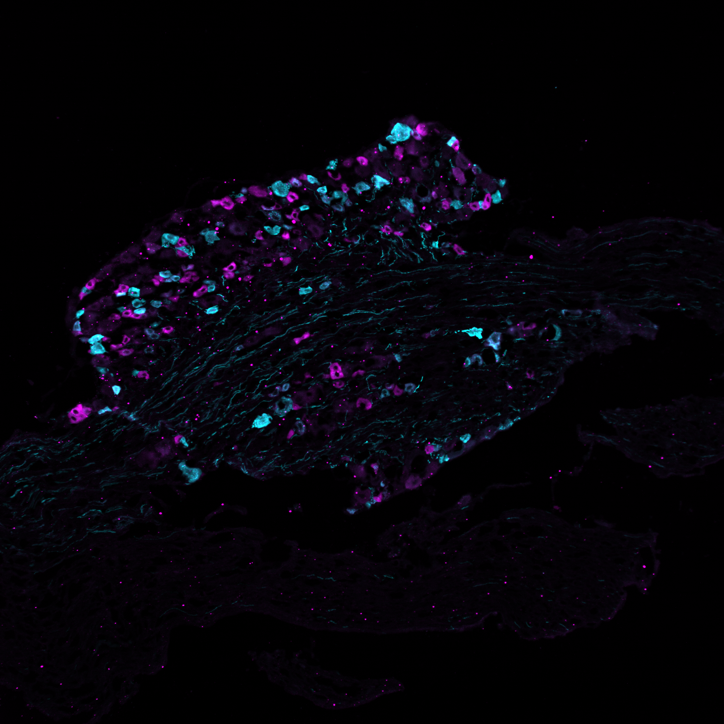 Schnitt durch ein Spinalganglion einer Maus, in dem zwei unterschiedliche Typen von Schmerzrezeptoren in Cyan (türkis) und Magenta (pink) angefärbt sind. © Sampurna Chakrabarti, Max Delbrück Center